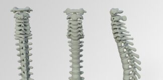 Co może być przyczyną wypadania zapłonu?